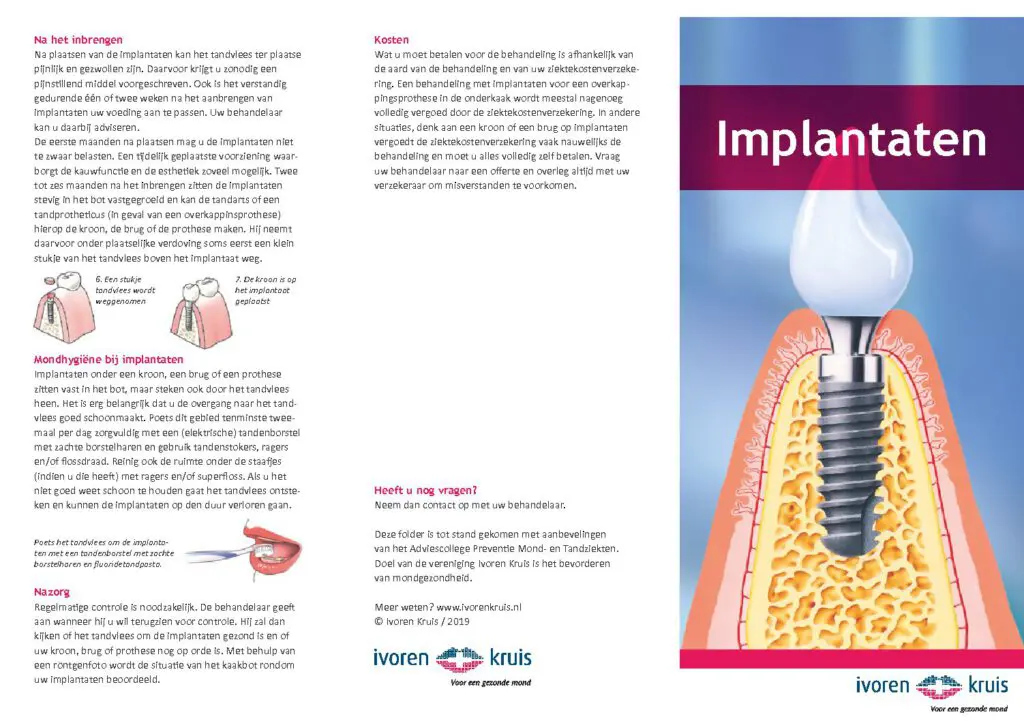 Ivoren Kruis Implantaten pdf 1024x721 1.jpg